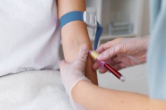 Professional blood sample collection